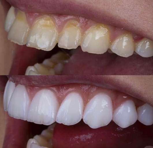 Carlos Felipe Sarmento Pereira-3