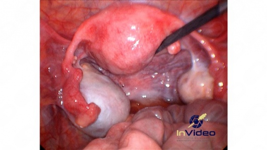 Leonardo Campbell-18