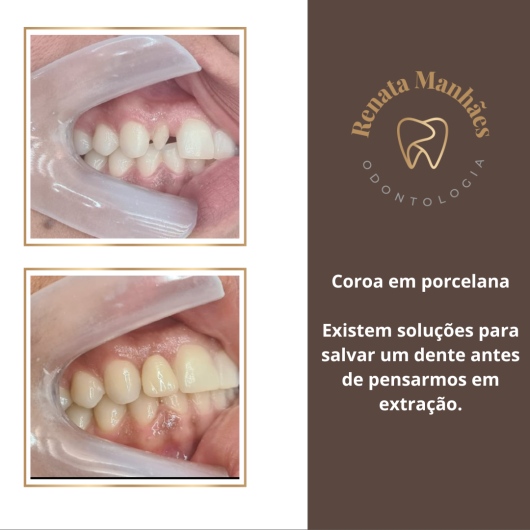 Renata De Paula Manhães-11