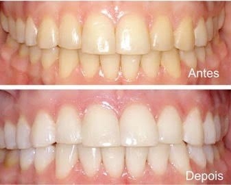 Iêda Interaminense-22