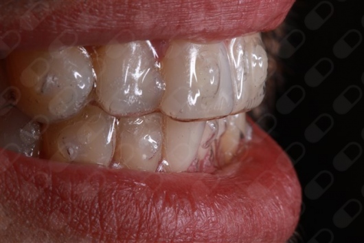 Roberto Soares Da Silva Júnior-6