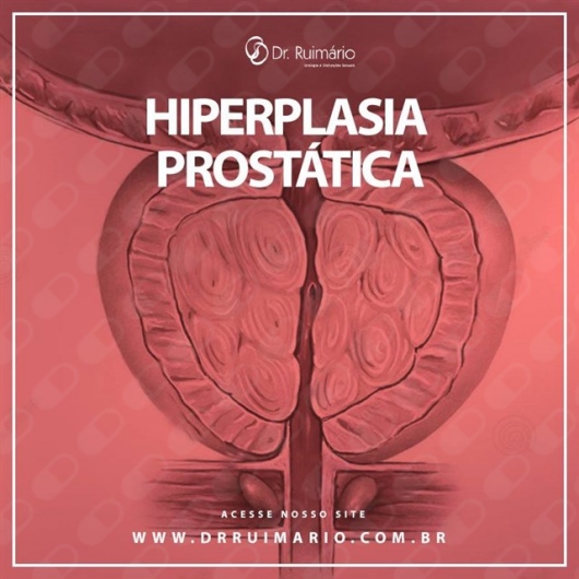 Ruimario Machado Coelho-6