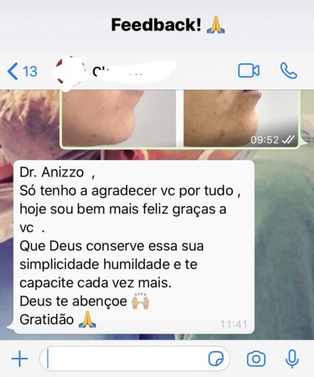 Anizzolavo Jesus-4