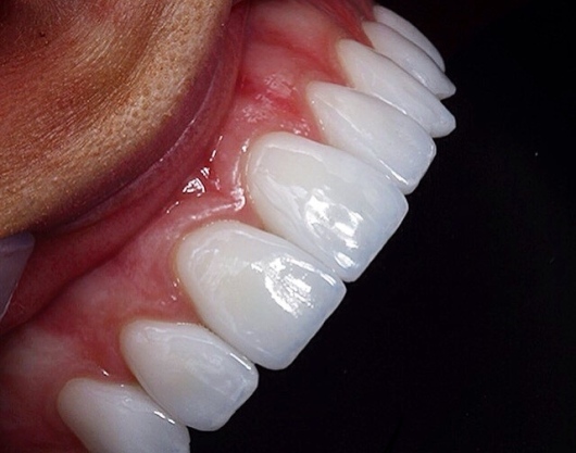 Marivane De Almeida Dos Santos-6