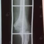 Dr. José Leite de Oliveira Neto