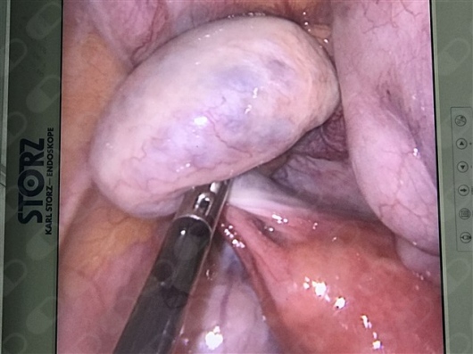 Hailton Jose Da Silva Sandes-0