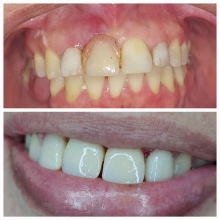 Deise Pim, Dentista São Caetano do Sul
