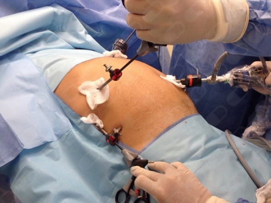 Guilherme De Andrade Gagheggi Ravanini-10