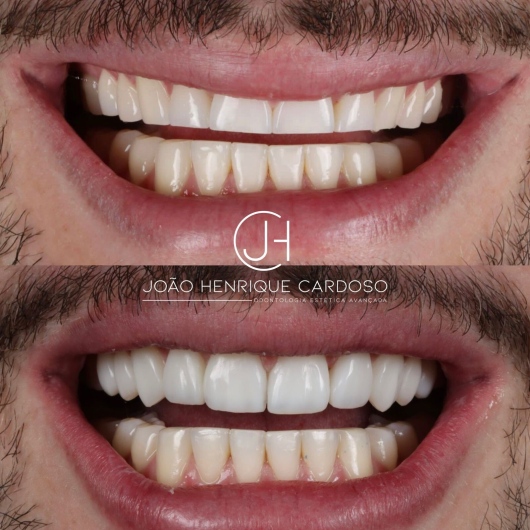 João Henrique Cardoso-1