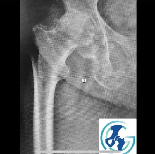 Gabriel Canto Tomazini-0