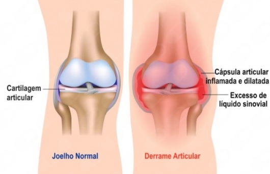 Breno Chaves De Almeida Pigozzo-5