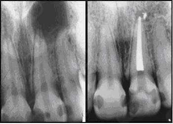 Iêda Interaminense-21