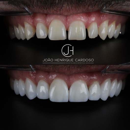 João Henrique Cardoso-3