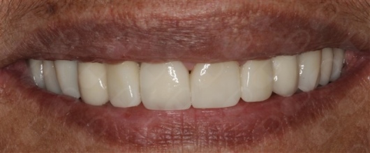 Antônio Alegria Do Nascimento-19