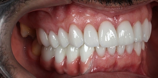 Marivane De Almeida Dos Santos-2