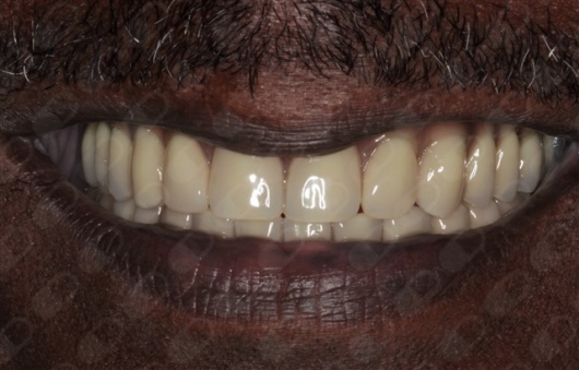 Antônio Alegria Do Nascimento-14