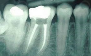 Iêda Interaminense-25