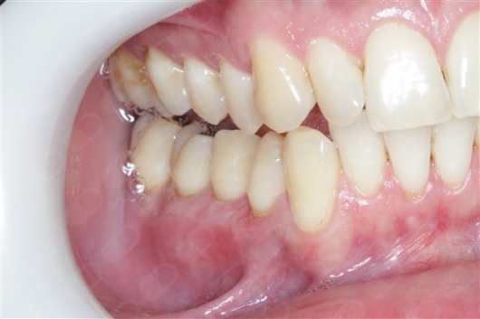 Antônio Alegria Do Nascimento-16