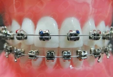 Iêda Interaminense-24