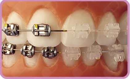 Iêda Interaminense-26