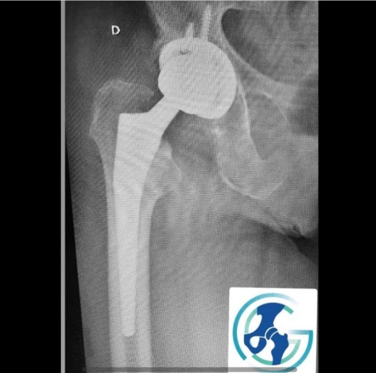 Gabriel Canto Tomazini-2