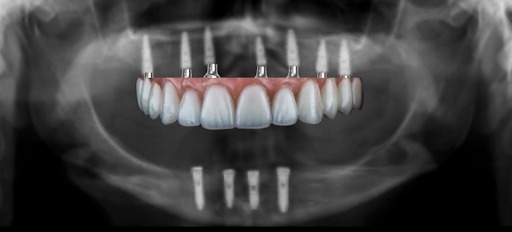 Marivane De Almeida Dos Santos-7