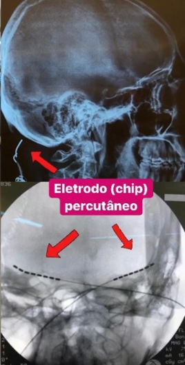Laura Moreno De Barros-1