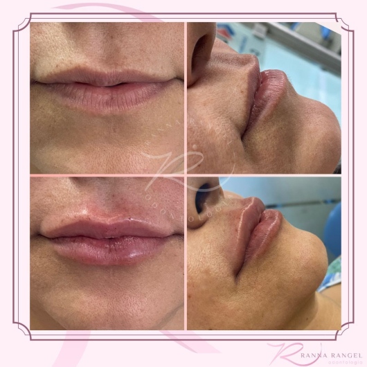 Ranna Rangel Saraiva-3