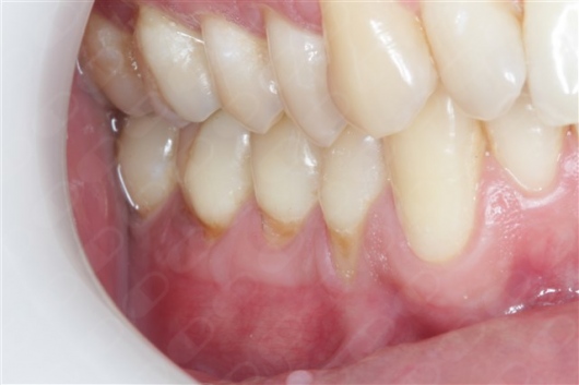 Antônio Alegria Do Nascimento-15