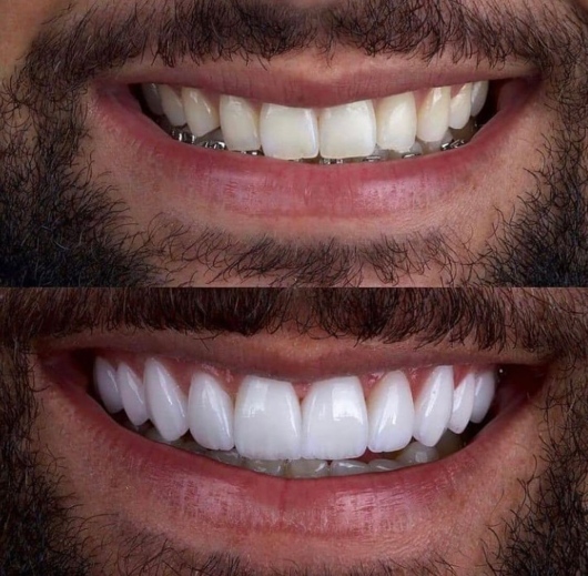 Carlos Felipe Sarmento Pereira-1