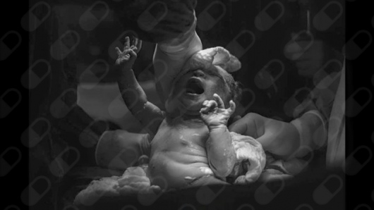 Fulvio Basso Filho-2