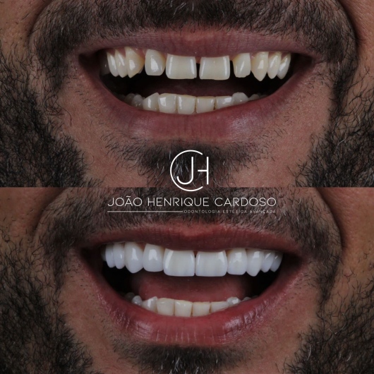 João Henrique Cardoso-2