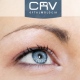 CRV Oftalmologia
