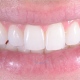 Prime Odontologia