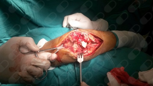 Cristian Calderon Garibay-0