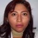 Dennice Morales Deza