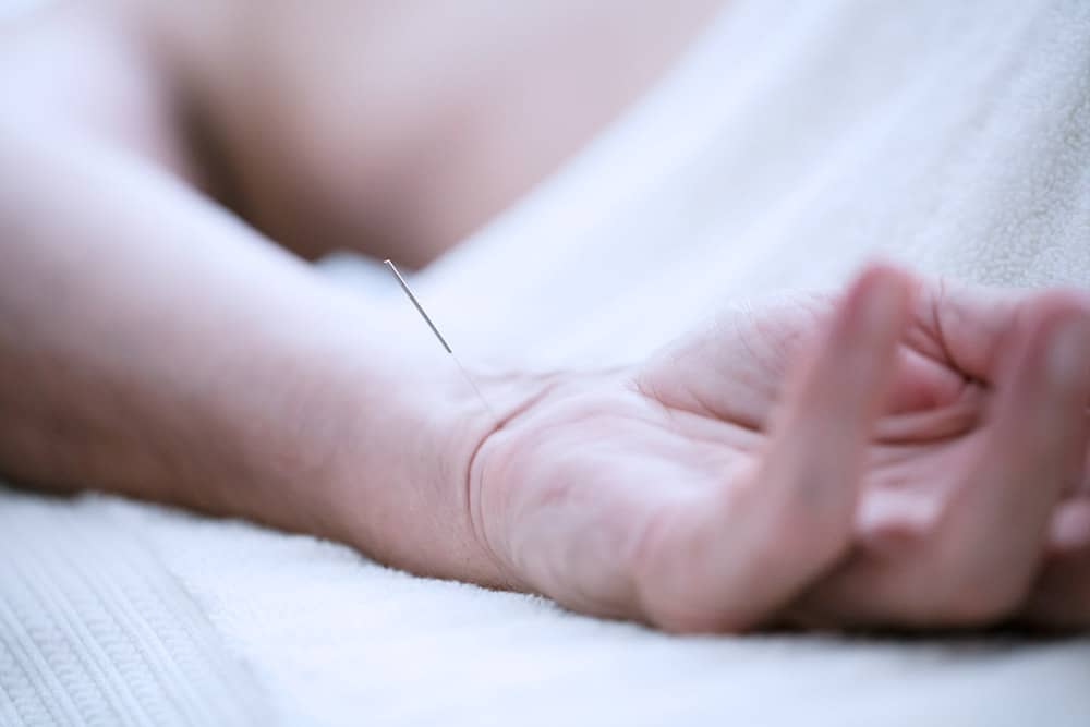 acupuntura para stress ansiedade