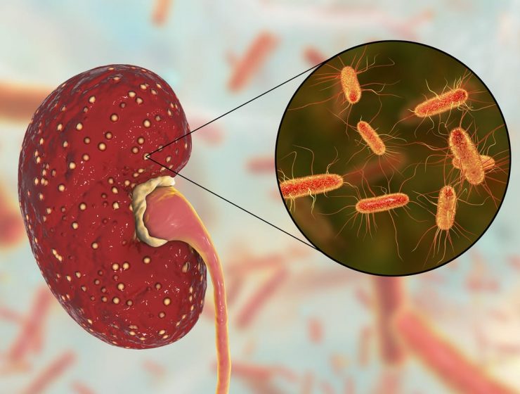sindrome urémico hemolítico sintomas contagio