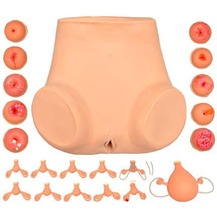 Simulador Ginecológico c/ Útero Saudável e Patológico-CS/AT-TGD-4024