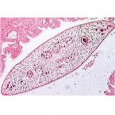Lâminas Preparadas de Parasitologia 30 peças-CS/AT-TIL-P-30