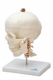 Crânio com Mandíbula Móvel e Coluna Cervical - CS/SD - 5008