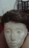 Proteses Capilar Masculina tradicional