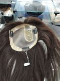 Proteses Feminina Full lace implantada na micropele couro cabeludo