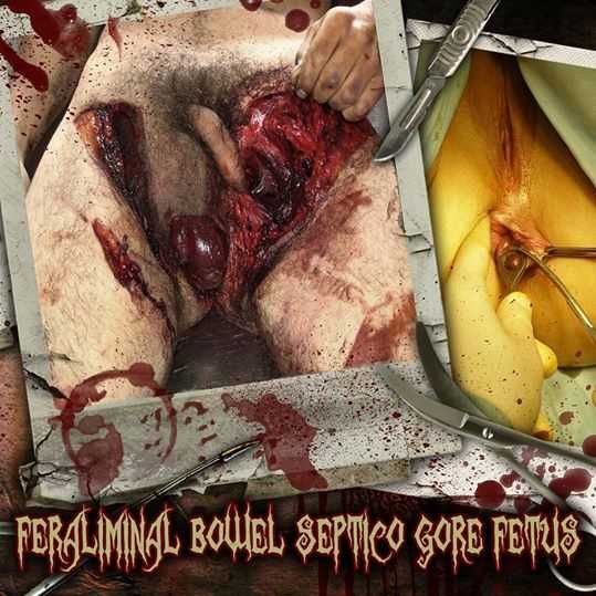 CD DEAD FETUS COLLECTION + GORE + SEPTICOPYEMIA + FERALAMINAL LYCANTHROPIZER + BOWEL STEW - Feralimi