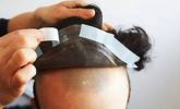 Proteses Capilar Masculina em Silicone/ Fixa
