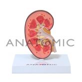 Rim com Patologias CS/AT/TZJ-0327-P