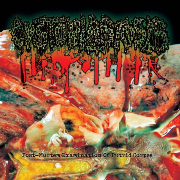 CD CYSTOBLASTOSIS - Post-Mortem Examination of Putrid Corpse