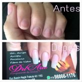 Alongamento de Unhas