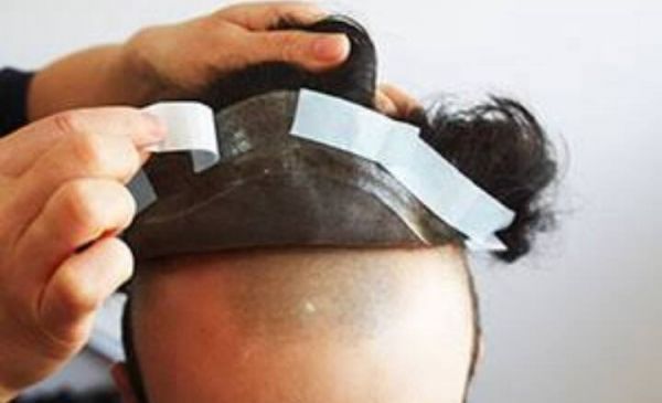 Proteses Capilar Masculina em Silicone/ Fixa