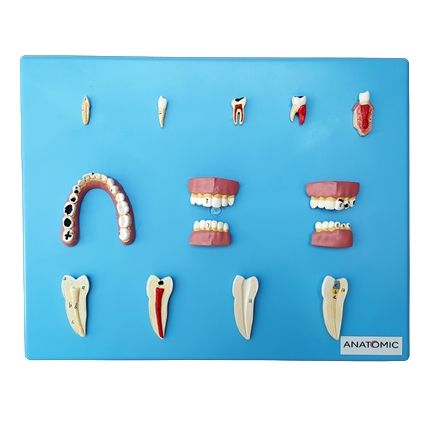 Placa c/ Doenças Dentárias 12 Pçs CS/AT/TZJ-0311-P